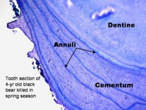 Microscope section of a tooth detailing cementum and annuli